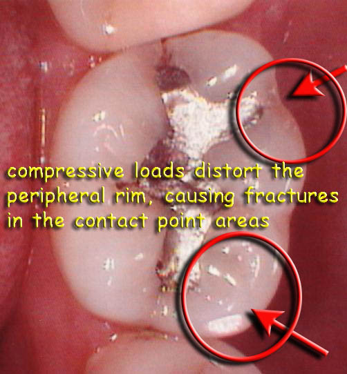 Occlusal effect5.1 web1.jpg